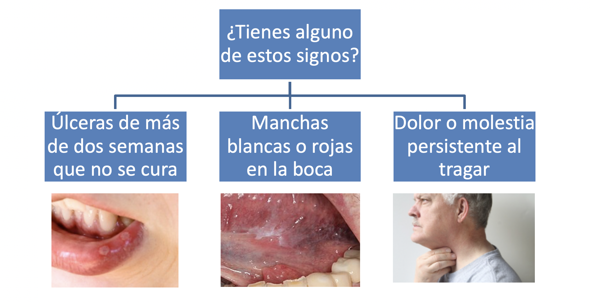 El Cáncer Oral Dentesia Clínica Dental En Valladolid 