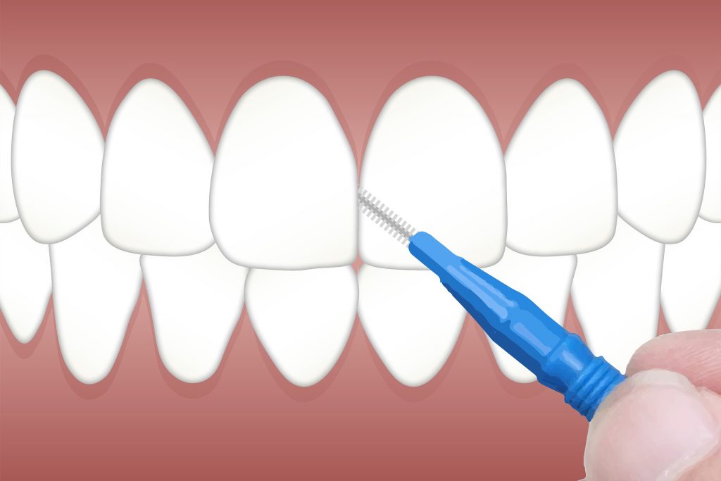 El Cepillo Interdental Y La Seda Dental Dentesia Clínica Dental En Valladolid 7583